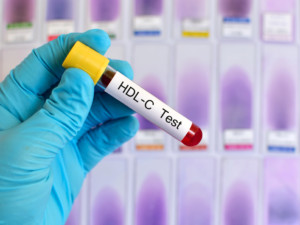  HDL Test Cholesterin © Jarun Ontakrai shutterstock